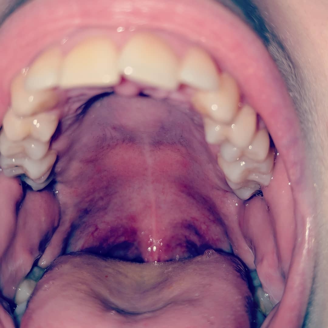 Fetish Vixen — 20